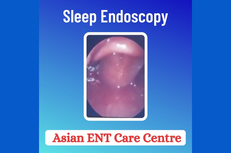 Sleep Endoscopy